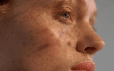 L’automne est là : offrez un nouveau souffle à votre peau