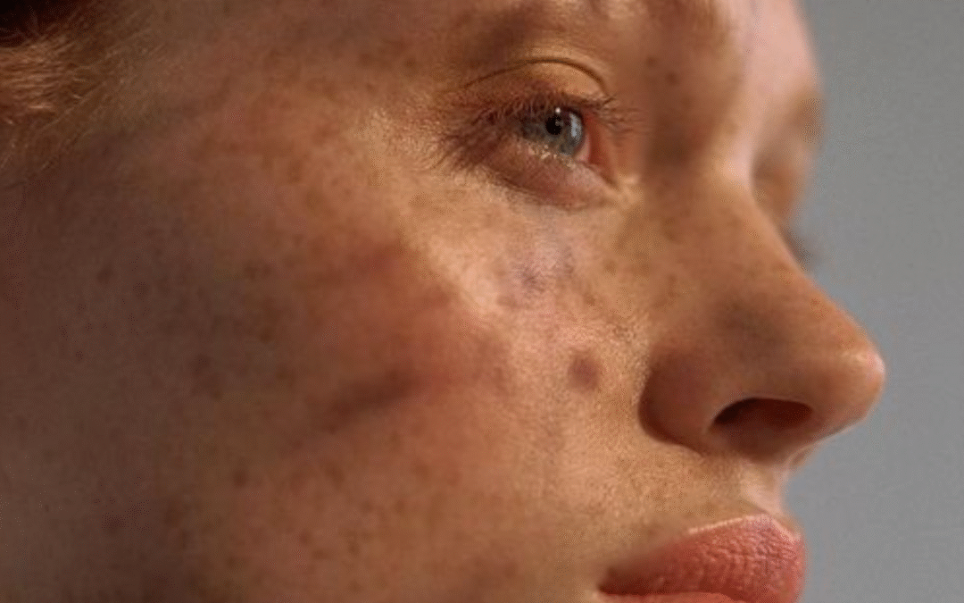 L’automne est là : offrez un nouveau souffle à votre peau